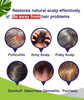 PHARMBANNER Anti-Fungal Shampoo for Folliculitis, Seborrheic Dermatitis, Scalp Psoriasis - Relieves Itchy & Dry Scalp