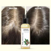 THE LIVING CO Shikakai + Bhringraj Stimulating Hair Oil For Hair Growth - 100ml