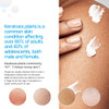 KP Essentials - Keratosis Pilaris Body Scrub and Exfoliator Cream Set - 10oz Exfoliating Set