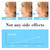 FERNIDA Silicone Nose Shaper Lifter Nose Uplifting Magic Clip Nose Bridge Straightener Corrector Slimmer for Wide Noses