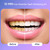 MySmile Deluxe 10 Min Teeth Whitening Kit with 28 LED Light, 35% Carbamide Peroxide Teeth Whitening Gel, Helps Remove Years of Stains from Coffee, So