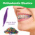 Orthodontic Rubber Bands for Braces - Premium Quality Elastic Teeth Rubber Bands for Braces, Fix Tooth Gaps, Dreadlocks, Includes Free Elastic Placer