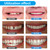 Temporary Teeth Repair Kit - Teeth replacement kit for temporary repair false tooth teaching