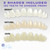 Instant Smile MULTISHADE Patented Temporary Tooth Repair Kit. A Realistic Looking Fix for a Missing or Broken Tooth.