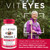 Viteyes AREDS 2 Zinc Free Macular Support, Natural Allergen Free Capsules with Vitamin E, Vitamin C, Lutein & Zeaxanthin, No Zinc, No Copper, Eye Doc