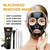 YLNALO Blackhead Remover Mask Kit, Charcoal Peel Off Facial Mask with Brush and Pimple Extractors, Deep Cleansing for Face Nose Blackhead Pores Acne,