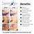 Dermlogic Acne Treatment Pads-Contains Glycolic, Lactic, Salicylic Acid. Eliminates Oily Skin, Clogged Pores & Cystic Breakouts. Removes Dark Spots,