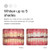 Opalescence 10% Teeth Whitening Kit - Gel Syringes Refills - Low Sensitivy (8 Units) - Fluoride, Carbamide Peroxide - Made in The USA by Ultradent 52