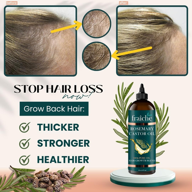 Live Fraiche Rosemary Castor Oil for Hair Growth 16oz - Rosemary Oil for Hair Growth and Thickening Pure Blend to Reduce Loss and Promote a Healthy S