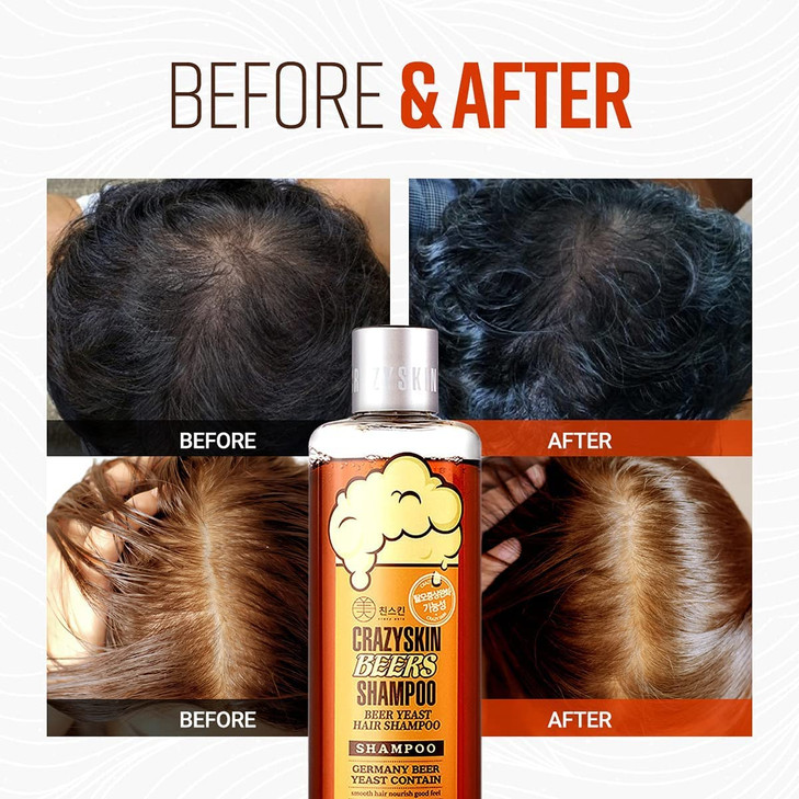 CRAZY SKIN German Beers Shampoo - 20.30 fl oz(300ml) X 2set, BIOTIN for hair loss, Rich with Beer Yeast for Regrowth and Thickening, Sulfate/Chemical