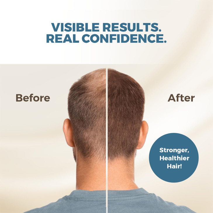 Hairmetto Ecklonia Cava Extract Hair Growth Serum  Styling Gel with Vitamins MSM, Niacinamide & Biotin Hair Growth Booster for all Hair Types - 4oz