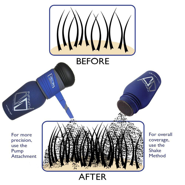 INFINITY Hair Fibers Black for Thinning Hair for Women & Men - 100% Undetectable Hair Building Fiber Powder - Conceal Hair Loss in 15 Seconds, 30g