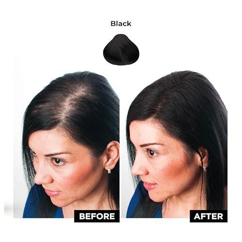 HAIRATIN Building Fibers for Thinning Hair, Black, 28G - Achieve Fuller, Natural Looking Results, Instantly Conceals Hair Loss in 10 Seconds, Thicken