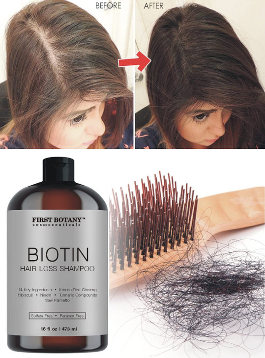 First Botany Cosmeceuticals, Hair Regrowth and Anti Hair Loss Shampoo 16 fl oz, with DHT blockers- Daily Hydrating, Detoxifying, Volumizing Shampoo F