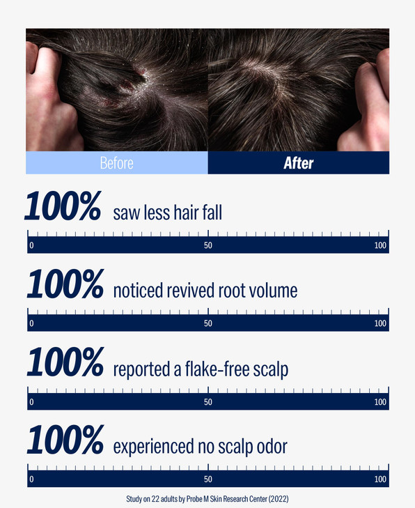 DASHU Revitalizing Protein Shampoo for Dry, Itchy Scalp, Thinning Hair, and Men - 16.9 fl oz