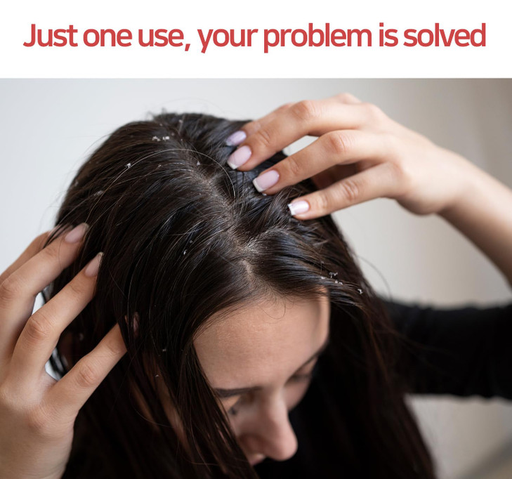 ZENOTRI Biotin and Zinc Pyrithione Shampoo - Combats Itching, Dandruff, Seborrhoeic Dermatitis & Sebum Buildup | Scalp Care Solution | 300ml 10 oz