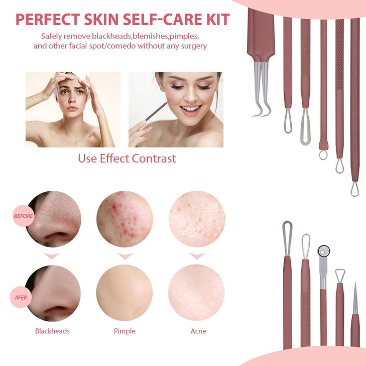 JPNK Blackhead Remover Tool Comedones Extractor Acne Removal Kit for Blemish, Whitehead Popping, 6 Pcs Zit Removing for Nose Face Tools with a Leathe