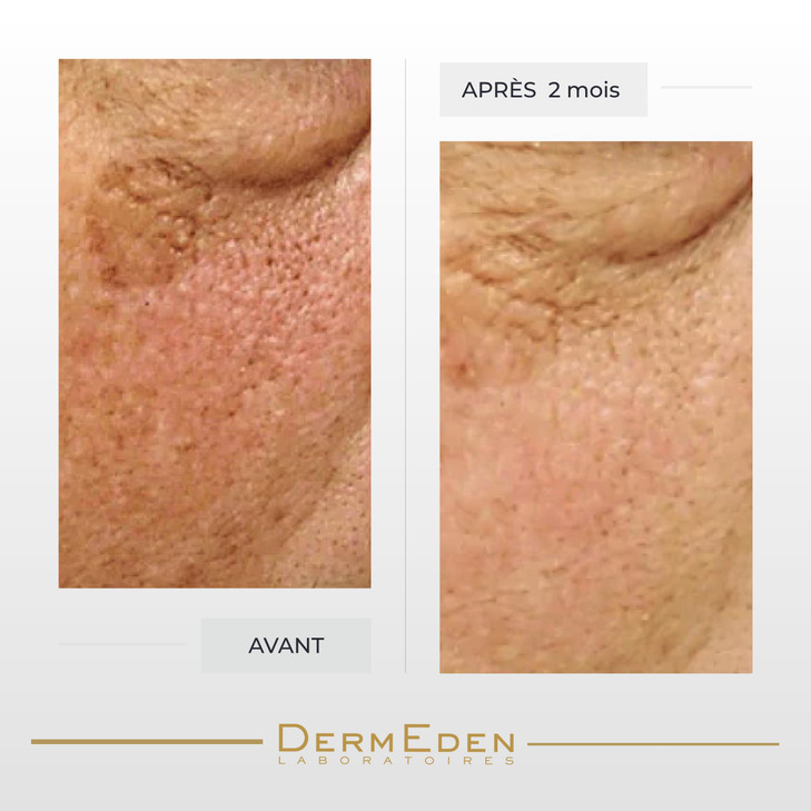 DERMEDEN NIGHT PROTOCOLE INTENSE ANTI-AGEING EYE CONTOUR CREAM 15ML 