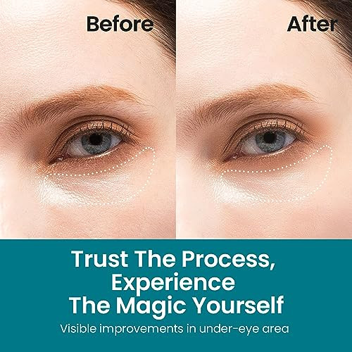 NURIVE Under Eye Patches for Dark Circles | Korean Under Eye Patches & Puffy Eye Patches | Moisturizing Dark Circles Under Eye Treatment Skincare Sna