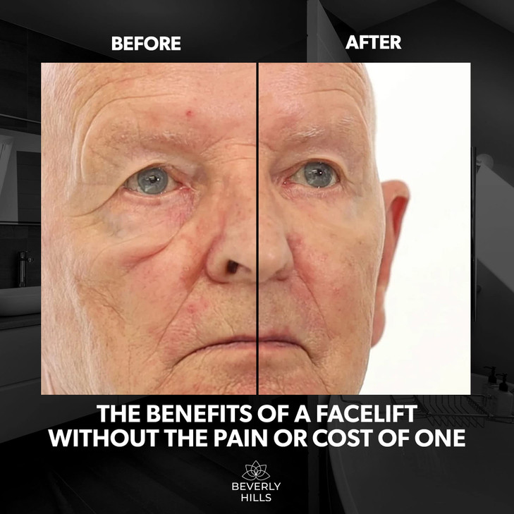 Beverly Hills Mens Instant Facelift and Eye Serum Treatment for Dark Circles, Puffy Eyes, and Wrinkles