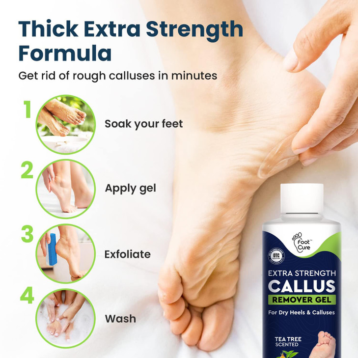 Callus Remover for Feet with Extra Strength Gel & Foot Pumice Stone Set - Easy Way to Remove Hard Calluses & Dead Skin Build-Up - Professional At-Hom