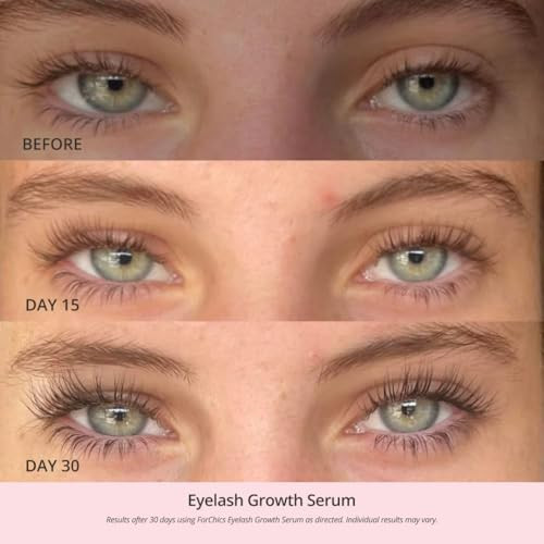 ForChics Eyelash Growth Serum - Prostaglandin-Free Lash Enhancing Serum for Longer, Thicker Lashes and Brows- Natural Formula, Visible Results in 2 W