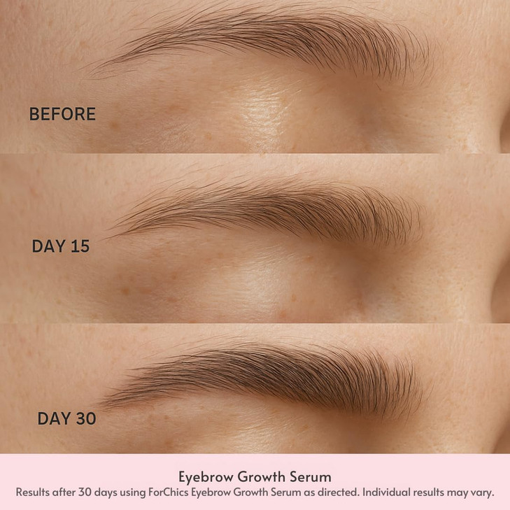 Eyebrow Growth Serum by ForChics - Natural Brow Thickening Treatment with Peptides and Biotin- Hormone-Free, Vegan and Cruelty-Free- Fuller Brows in