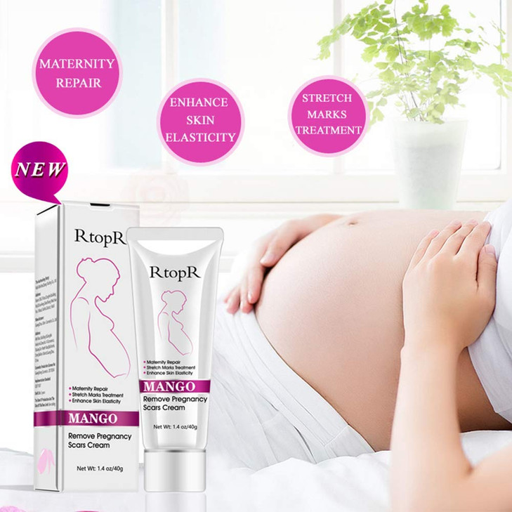 Mango Stretch Marks and Scar Cream, Stretch Mark and Scar Removal Cream for Pregnancy, Belly Creams for Wrinkles, Obesity Fat Marks Scars Moisturizin