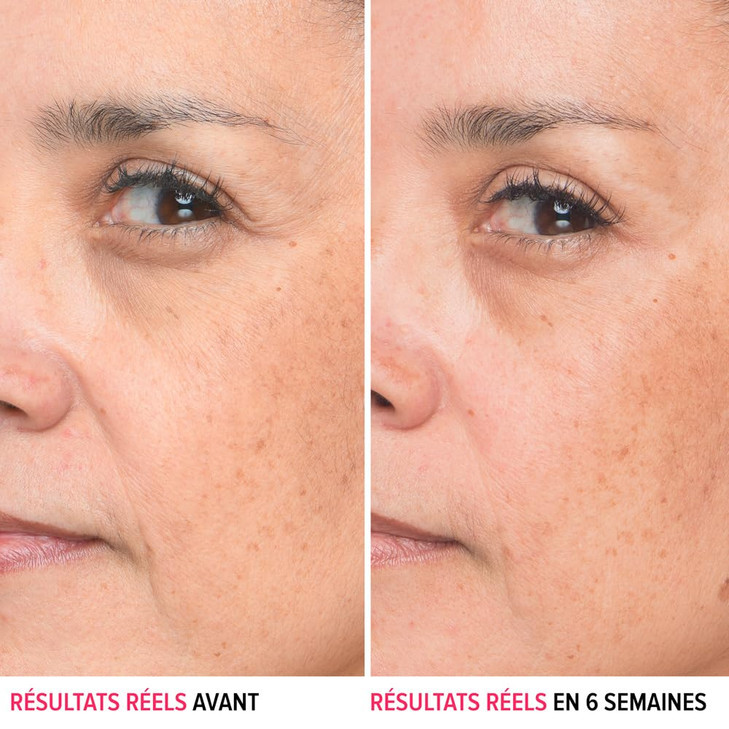IT Cosmetics Bye Bye Lines Hyaluronic Acid Serum for Face - Hydrating Anti-Aging Facial Serum With Peptide & Vitamin B5, Visibly Plumps Skin, Smooths
