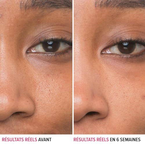 IT Cosmetics Bye Bye Pores 10% Glycolic Acid Face Serum - Visibly Minimizes Pores In 1 Week & Gently Exfoliates to Help Refine Skins Texture - With