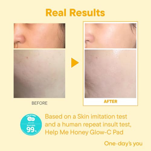ONE-DAYS YOU Help Me Honey Glow-C Pads | Korean Vitamin C Toner Pads for Face | Brightening & Cleansing Facial Pads | Skin Care for Blemishes & Radi