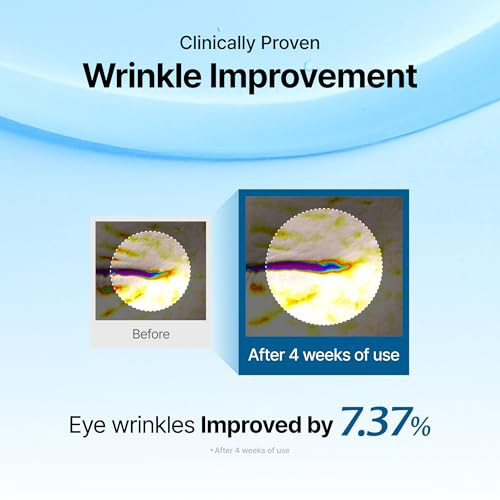 DearKlairs Korean EGF Serum  Blue Youth Activating Drop with EGF Peptides and Guaiazulene, Repairing Serum for Redness and Blemish-prone Skin, Visib