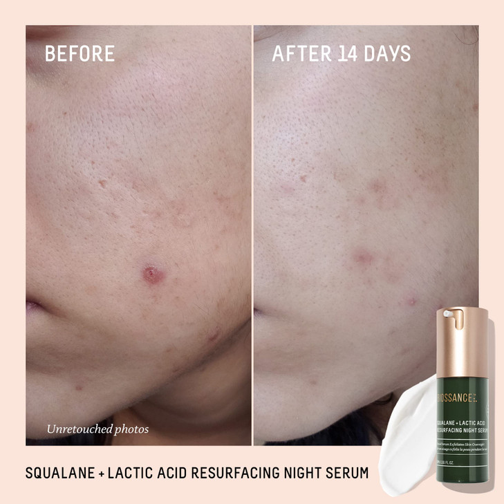 Biossance Squalane + Lactic Acid Resurfacing Night Serum - Vegan 10% Lactic Acid Face Serum for Skin Texture and Fine Lines - Gentle Night Exfoliant,