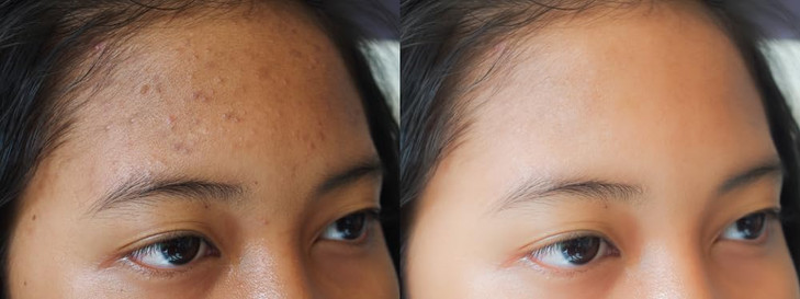 Vitality Precision Skin Snail Mucin Serum 97% Concentrate