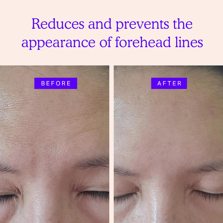 Blumbody Forehead Wrinkle Patches - Anti Wrinkle Facial Patches to Smooth Eyes & Forehead Wrinkles - Non-Silicone Face Tape for Fine Wrinkles between