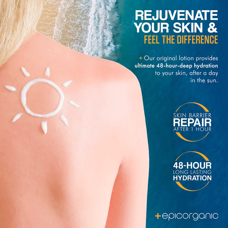 Epic Organicum After Sun Lotion | Sunburn Relief | Aloe Vera & Vitamin E Cream | Body Lotion & Face Moisturizer | Lotion for Dry Skin | Itchy Skin Re