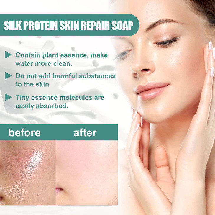 YG LianKai 2PCs SkinFerm Collagen Milk Whitening Soap, Silk Protein Skin Repair Soap, Exfoliating and Brightening Soaps for Dull, Uneven Skin, Smooth