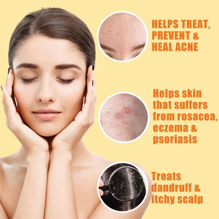 10% Sulfur Soap Cleansing Bar for Face & Body  All Natural Facial Cleanser for Acne, Oily Skin  Healing Skincare Blend of Lemongrass, Tea Tree Esse