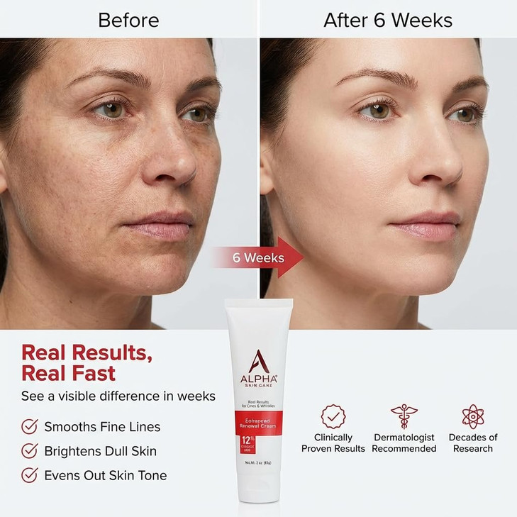 Alpha Skin Care Enhanced Renewal Cream, Anti-Aging Formula, 12% Glycolic AHA, Reduces Lines & Wrinkles, Normal to Dry Skin, 2 Oz, Pack of 1