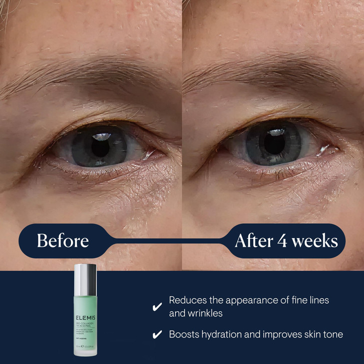 ELEMIS Pro-Collagen Tri-Acid Peel, 1 fl. oz.