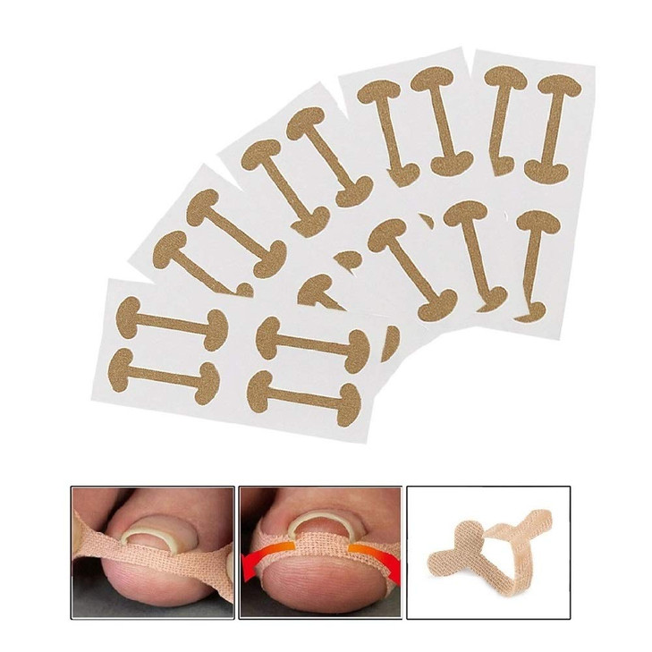 EBANKU Ingrown Toenail Treatment Strips, 20 Pcs Toe Nail Correction Patch Elastic Patch Sticker Corrector Pedicure Tools Fingernail Toe Nail Care