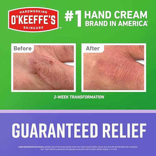 O'Keeffe's Working Hands Night Treatment Hand Cream for Extreme Dryness - 7 oz Tube (1 Pack) - Repairing Skincare for Cracked, Dry Hands