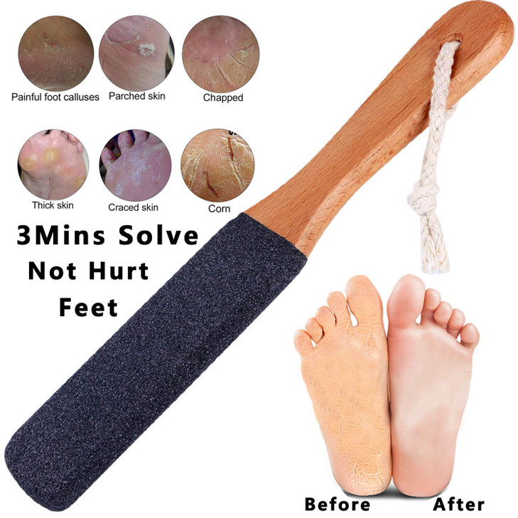 Kinepi Foot File Callus Remover Foot Scrubber,Professional Pedicure Foot Rasp Removes Cracked Heels,Dead Skin,Corn,Hard Skin,Pumice Stone for Scraper