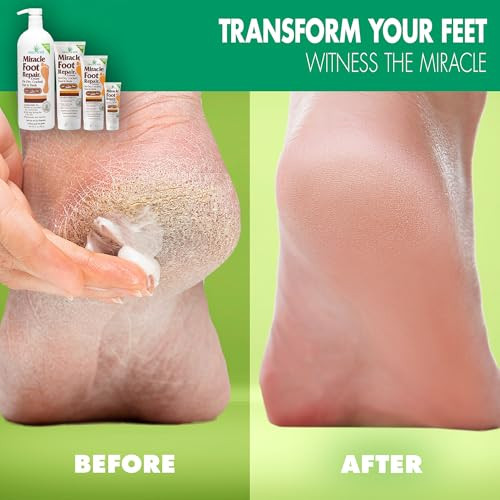 Miracle Foot Repair Cream (8 oz / 2-Pack) Repairs Dry Cracked Heels and Feet, 60% Pure UltraAloe Moisturizes, Softens, and Repairs