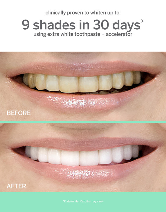 Supersmile Extra White Professional Whitening Accelerator - Enamel-Safe Teeth Whitening Gel - Effectively Lifts Deep-Set Stains Without Sensitivity -