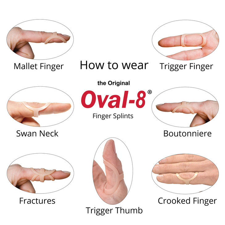 3-Point Products Oval-8 Finger Splint Package of 1 (Size 11)