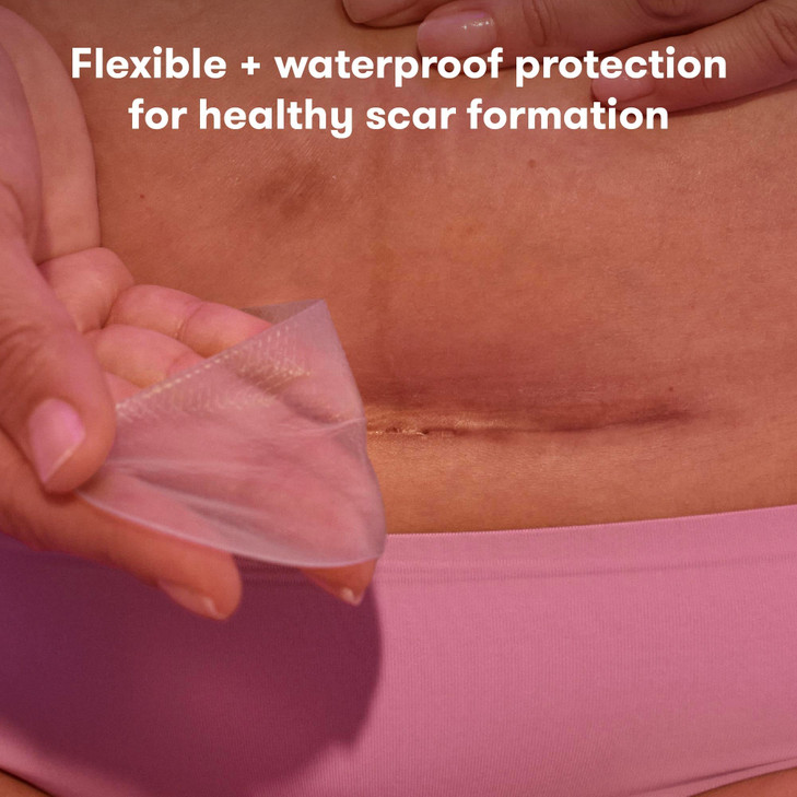 Frida Mom C-Section Silicone Strips, C-Section Recovery Must Have Scar Patches, Reusable Medical Grade Treatment for Keloid Scars, Includes Case & Po