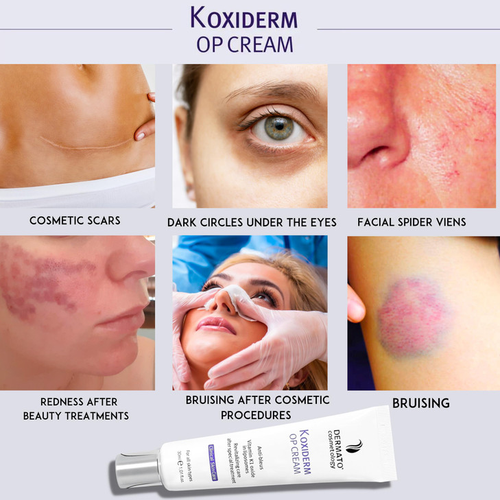 Anacis Vitamin K1 Oxiderm Cream Minimizing Appearance of Old and New Scars, Dark Eye Circles, Bruises, Varicose Veins, Purpura and Redness 1.01Oz