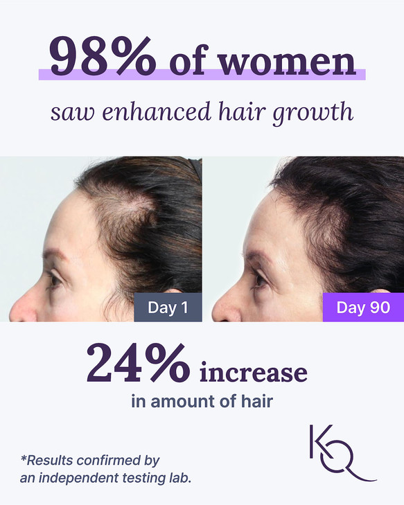 Keranique Hair & Scalp Supplements - Promote Strength and Growth Best for Thinning Nourish Your with Biotin, Vitamin B, More Vital Nutrients Keraviat