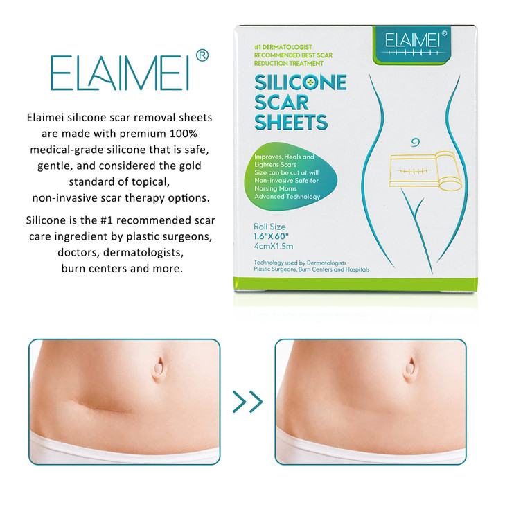 Medical Grade Silicone Scar Sheets, Silicone Scar Tape (1.6x 60), Scar Removal